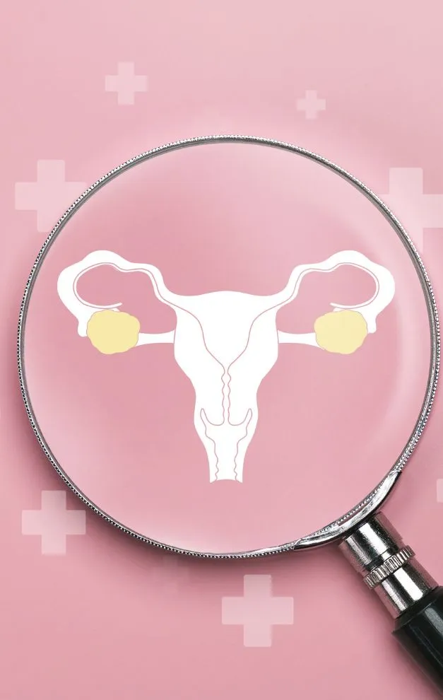 ovarian cyst treatment in dubai