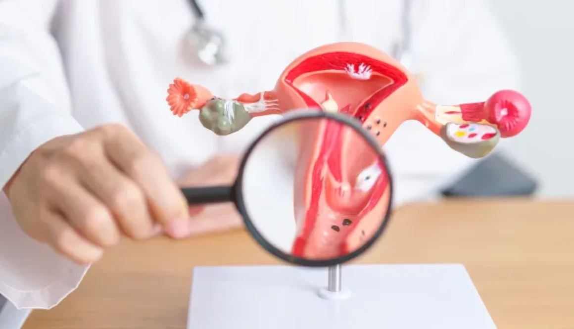 Uterine-Fibroid-Treatment-pic_3