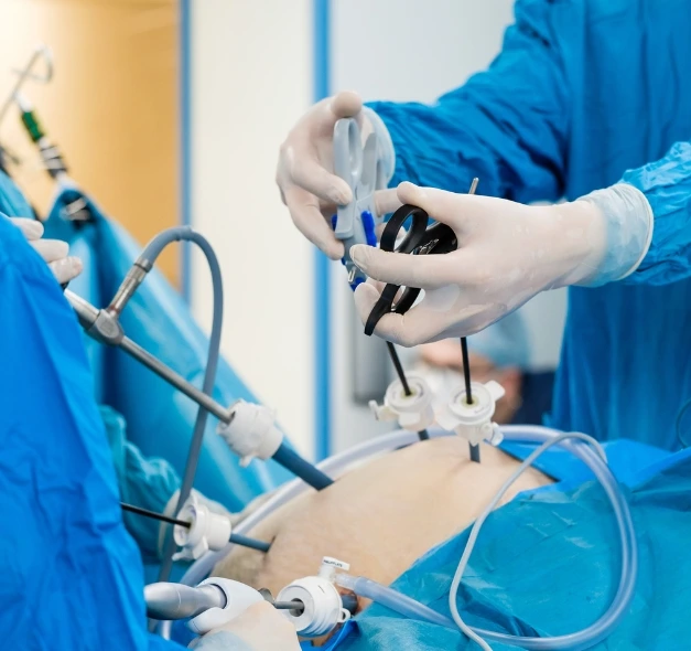 laparoscopic gynecology