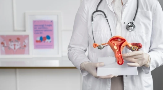 pcos (1)