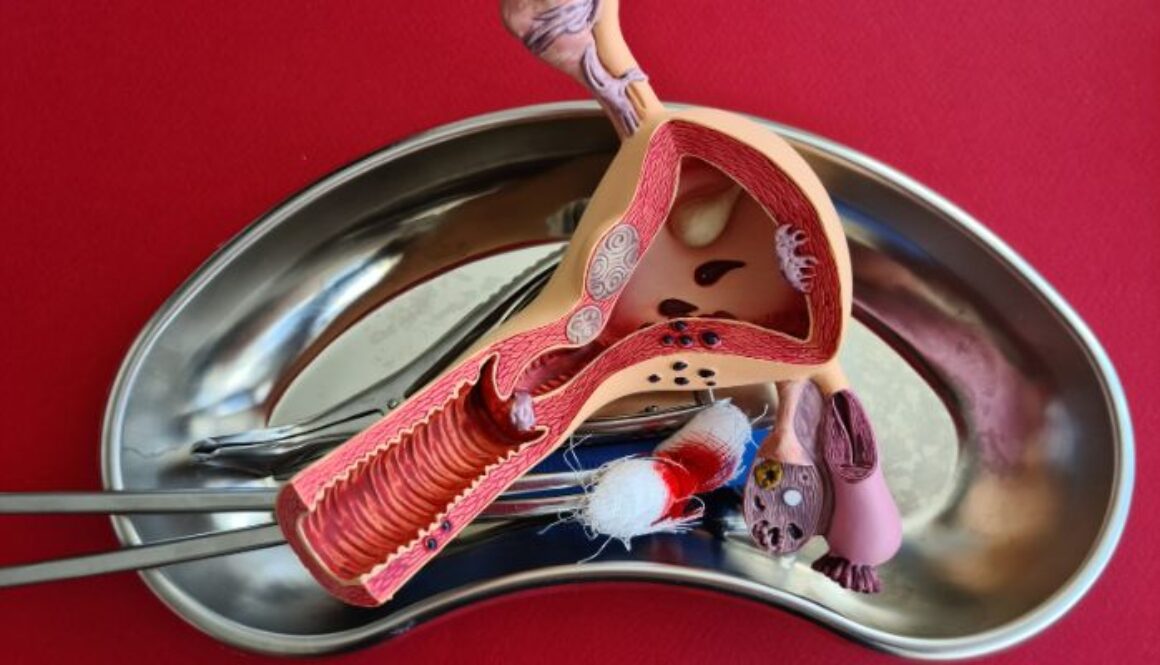 Hysterectomy-recovery