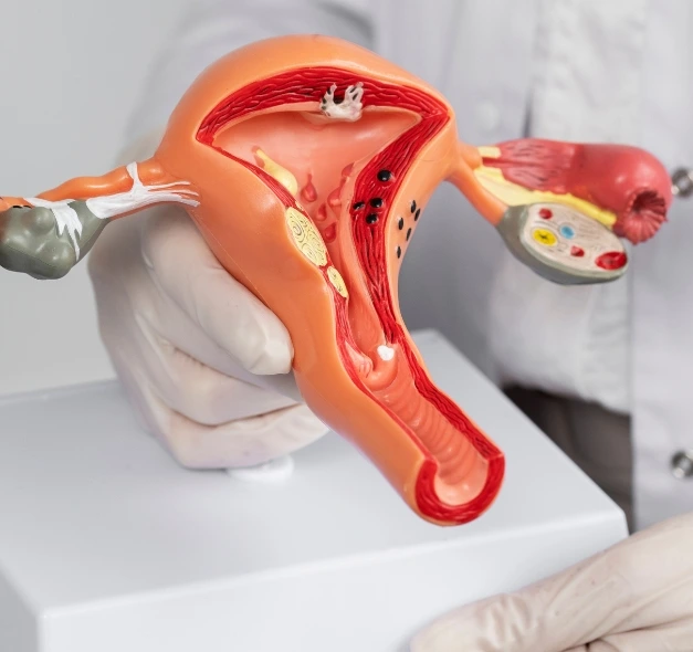 hysterectomy