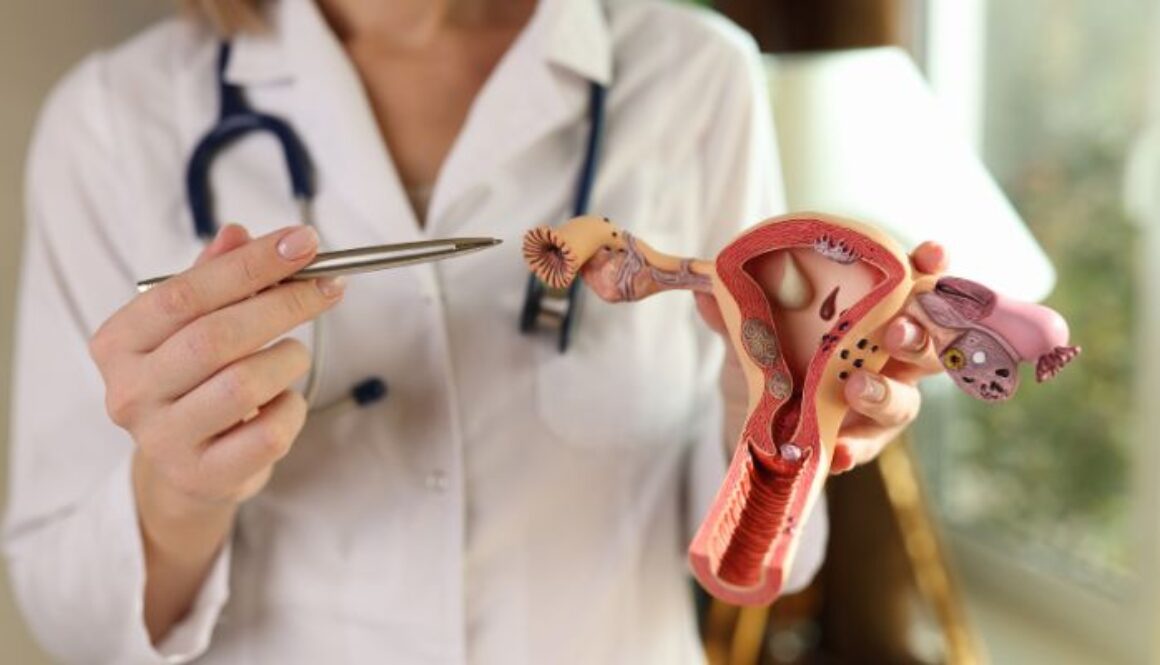 ovarian-cancer