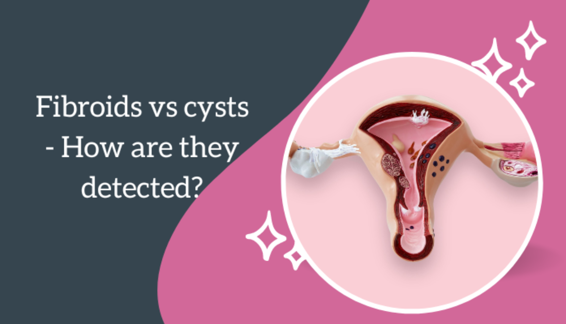 Fibroids-vs-cysts