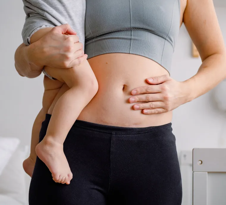 c-section delivery